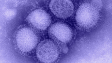 Chủng cúm H1N1 đang hoành hành ở Nga