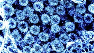 Hình ảnh từ kính hiển vi do Viện nghiên cứu bệnh truyền nhiễm và dị ứng quốc gia Mỹ cung cấp cho thấy virus SARS-CoV-2 trong mẫu bệnh phẩm của bệnh nhân mắc COVID-19. Ảnh (tư liệu) minh họa: AFP/TTXVN