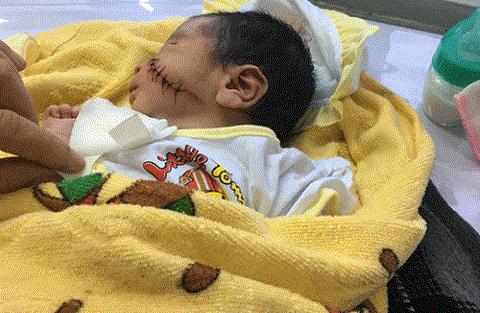 Cháu bé bị chôn sống đang được điều trị tại Bệnh viện Đa khoa Khu vực La Gi, Bình Thuận (Ảnh báo Bình Thuận).