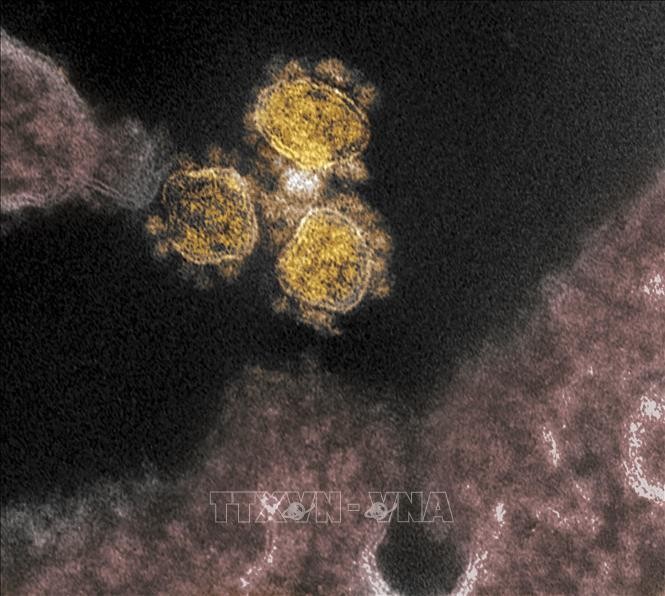 Hình ảnh quét qua kính hiển vi điện tử cho thấy virus SARS-COV-2 trên mẫu bệnh phẩm của bệnh nhân COVID-19 tại Viện Nghiên cứu Dị ứng và Bệnh Truyền nhiễm Quốc gia, Mỹ. Ảnh: AFP/TTXVN