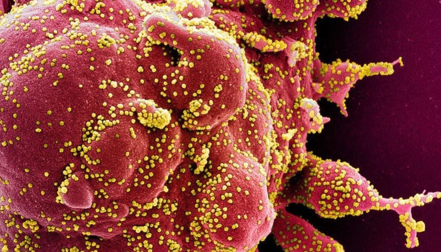 Các nhà khoa học cho biết một chủng Omicron mới có khả năng vượt trội trong việc né tránh hệ miễn dịch và điều trị bằng kháng thể hiện có. Ảnh: AFP