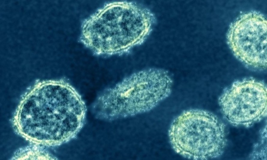 Chủng mới của virus H1N1 đang lây lan mạnh ở Trung Quốc