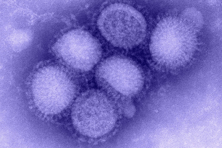 Chủng cúm H1N1 đang hoành hành ở Nga