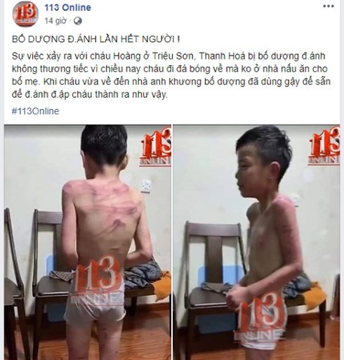 Hình ảnh thông tin lan truyền trên mạng xã hội về bé trai bị cha dượng bạo hành. (Ảnh chụp màn hình)