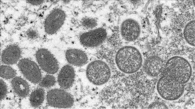 Hình ảnh dưới kính hiển vi do Trung tâm kiểm soát và phòng ngừa dịch bệnh công bố về virus đậu mùa khỉ. Ảnh minh họa: AP/TTXVN