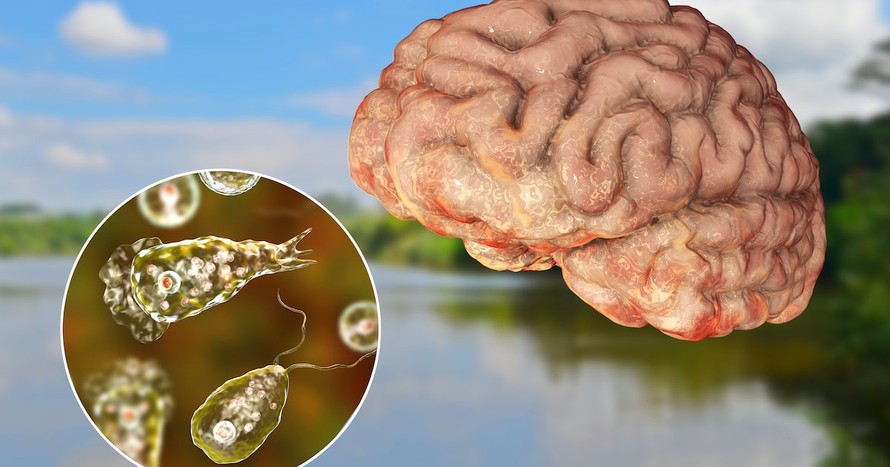 "Amip ăn não" dễ sinh sôi trong môi trường nước ngọt ấm, có thể lây nhiễm vào mũi và xâm nhập lên não người. Ảnh: Newsroom