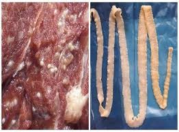 Bệnh sán lợn là do người bệnh ăn phải thức ăn bị ô nhiễm có nhiễm trứng sán dây lợn hoặc ấu trùng sán lợn (như thịt lợn gạo) chưa được nấu chín kỹ.