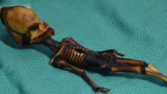Bộ xương bị nghi ngờ là của người ngoài hành tinh. Ảnh: UCSF.