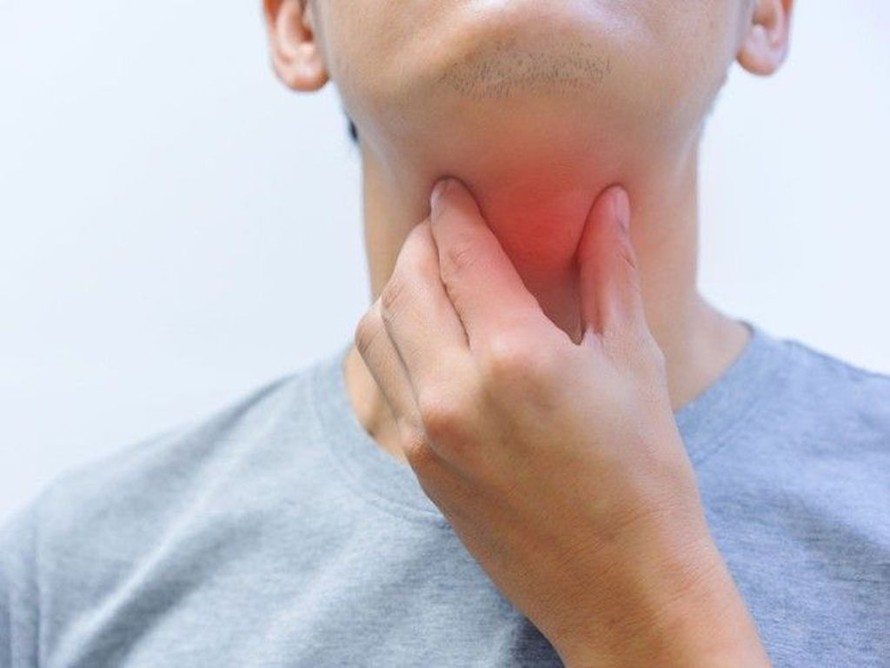 Triệu chứng của bệnh bạch hầu là đau họng, sốt, sưng cổ, có mảng màu xám dày ở họng và amiđan. (Ảnh minh hoạ)