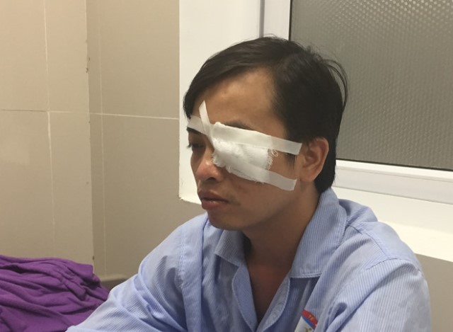Bác sĩ Trần Văn Sơn bị nhóm của Hải đánh gây chấn thương hốc mắt khi can ngăn những người này đánh anh Tâm. Ảnh:N.T.