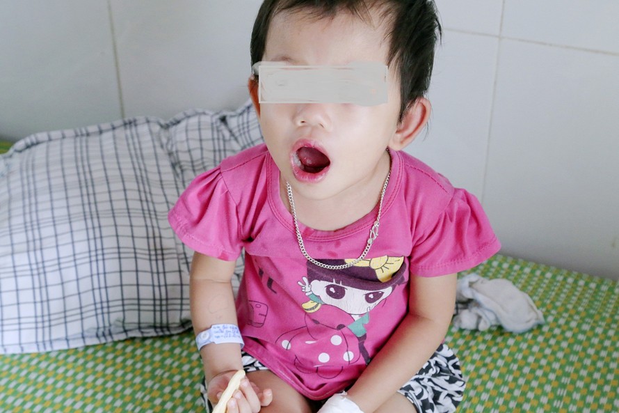 Một bệnh nhi điều trị bệnh tay chân miệng tại Bệnh viện Đa khoa tỉnh Phú Thọ.