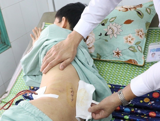 Bệnh nhân bị dao đâm thấu bụng nguy kịch được cứu sống nhờ hệ thống “báo động đỏ” của BV Đa khoa Hà Đông, Hà Nội.