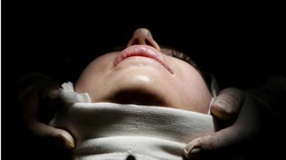 Trung Quốc: Phẫu thuật “trẻ hóa” từ 59 tuổi thành gái 30 hòng trốn nợ