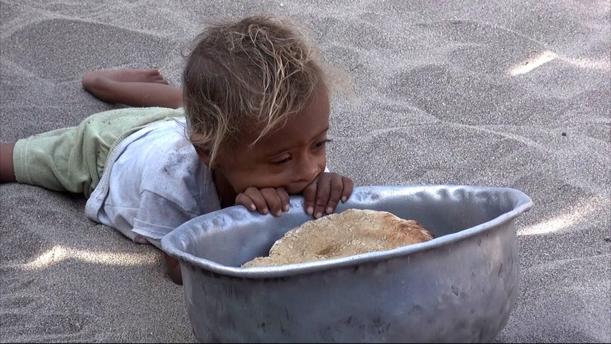 Chiến tranh, nạn đói: Cơn ác mộng của người Yemen