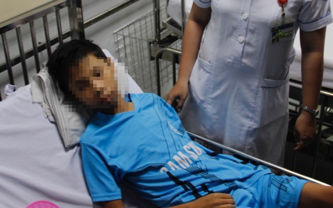 Cậu bé lớp 8 ở Bình Phước bị kim may quần áo đâm vào ngực rồi vào tim