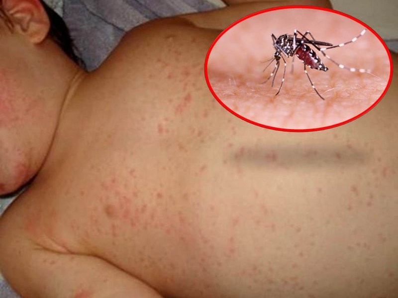 Phun hóa chất diệt muỗi có 'chống' được sốt xuất huyết?