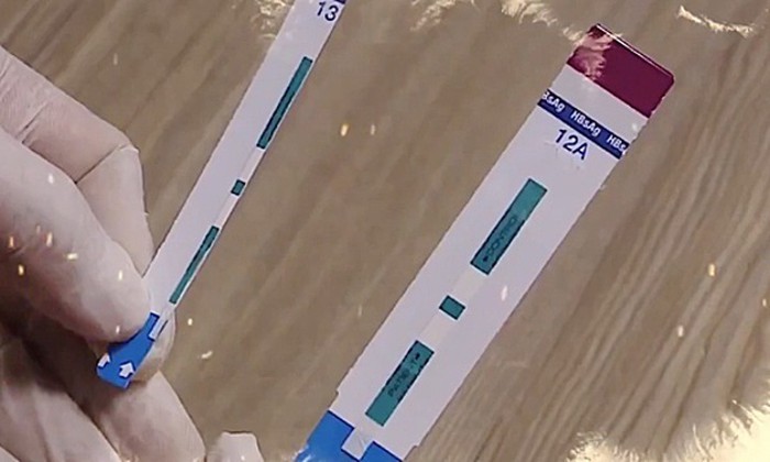 Lập đoàn thanh tra việc sử dụng test thử HIV, viêm gan B tại Bệnh viện Xanh Pôn