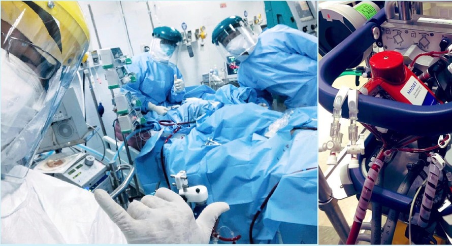 Bác sĩ Hiếu (ngoài cùng bên trái) và đồng nghiệp vui mừng khi cai ECMO thành công cho một bệnh nhân nặng tại ICU Bệnh viện Phổi Đà Nẵng. Ảnh Bác sĩ cung cấp.