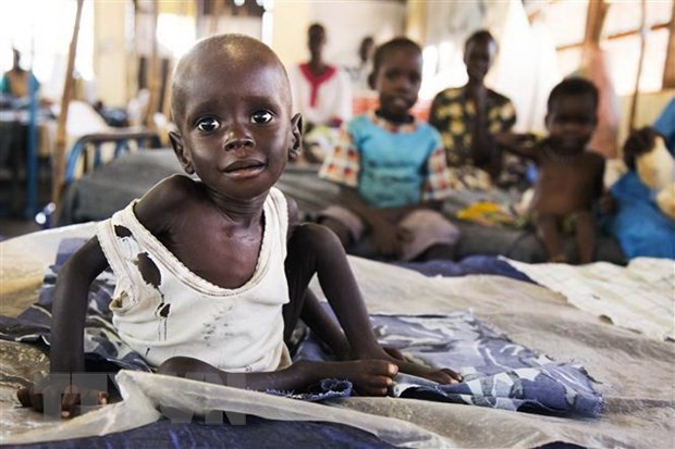 Trẻ em bị suy dinh dưỡng điều trị tại cơ sở y tế ở Aweil, Nam Sudan. (Ảnh: AFP)
