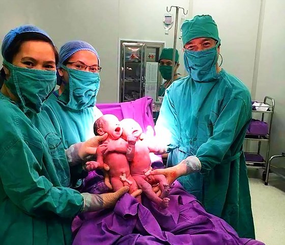 Các bác sĩ Bệnh viện Sản Nhi Quảng Ninh đón 2 trẻ sinh đôi từ IVF