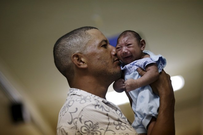 Dịch Zika gây dị tật đầu nhỏ ở trẻ sơ sinh Ảnh: Reuters. 