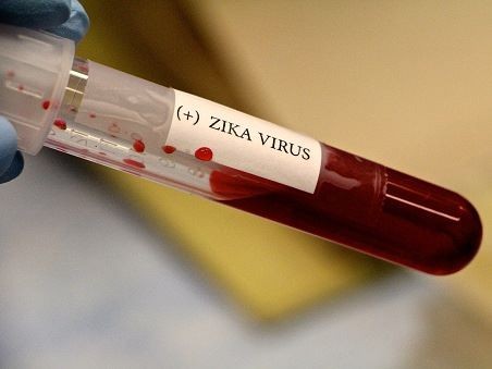 Gần 80 ca nhiễm virus Zika trên cả nước