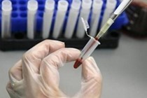 6 xét nghiệm máu cần làm trước 30 tuổi