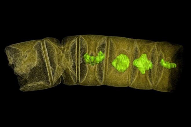 Ảnh chụp tia X hóa thạch giống tảo đỏ. Ảnh: Reuters.