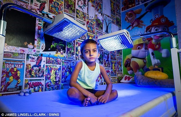 Ismail Ali phải dành 20 tiếng mỗi ngày ở trên chiếc giường gắn đèn điện này. Ảnh: James Linsell-Clark/SWNS.