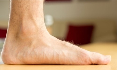 Lòng bàn chân của người bị bàn chân bẹt tiếp xúc trực tiếp với mặt đất.