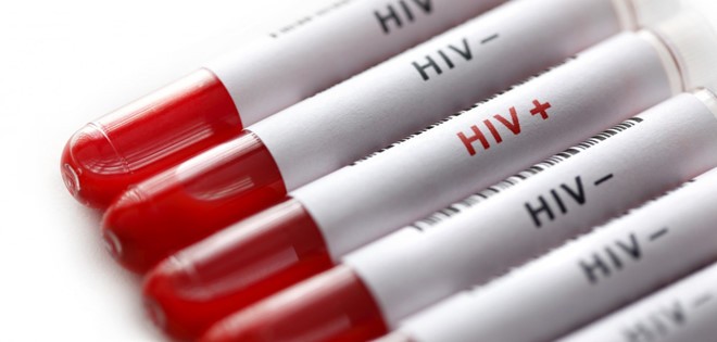 Quan hệ tình dục bừa bãi là nguyên nhân chủ yếu dẫn tới việc lây nhiễm HIV. Ảnh: Istock.