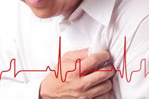 Sự khác biệt giữa đột quỵ và cơn đau tim