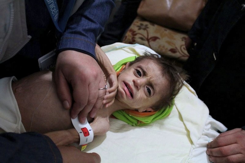 Một em bé tại Ghouta. Ảnh: AP