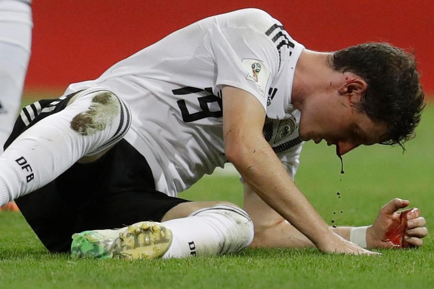 Tiền vệ Sebastian Rudy của Đức lỡ trận gặp Hàn Quốc sau khi phẫu thuật mũi