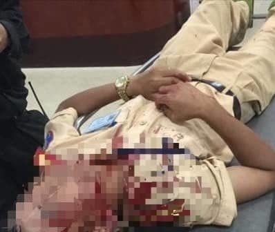 Đại úy Mai Hồng Sơn bị thương ở vùng đầu sau khi bị tấn công. Ảnh: Tiền Phong