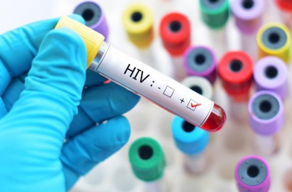 Phát hiện ra chủng HIV mới lần đầu tiên sau 19 năm