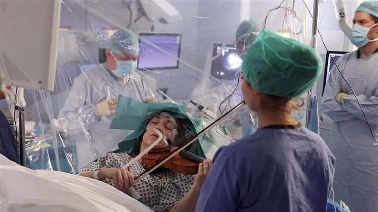 Bệnh nhân chơi đàn violin khi phẫu thuật não