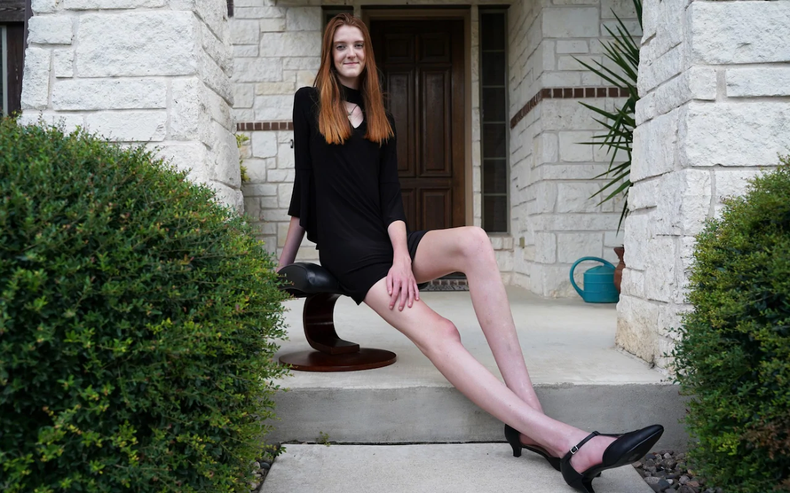 Cô gái 17 tuổi có đôi chân dài nhất thế giới