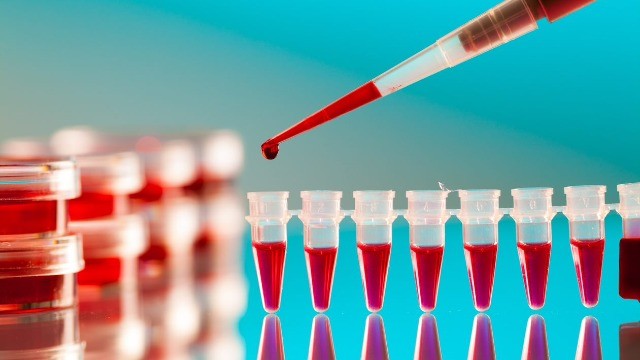 Xét nghiệm máu có thể phát hiện 50 loại ung thư 