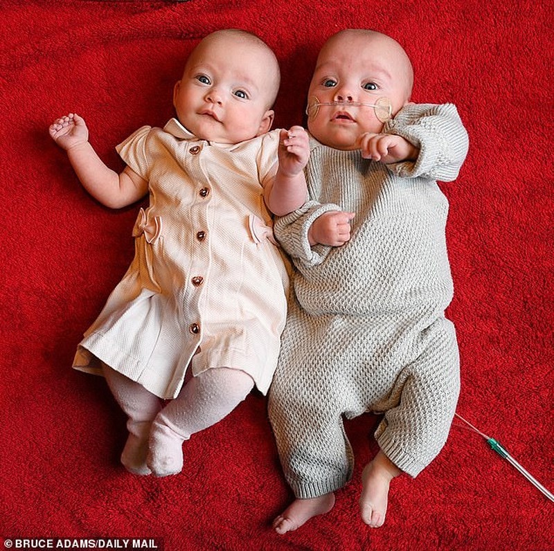 Presley (phải) và Paisley (trái) là cặp song sinh 1 trai 1 gái sinh cách nhau 12 ngày. Ảnh: DM