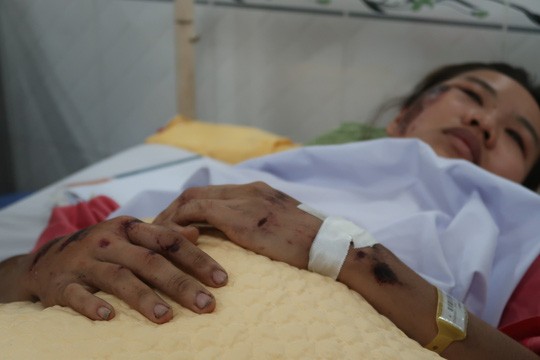 Một nạn nhân đang được theo dõi tại Bệnh viện Chợ Rẫy