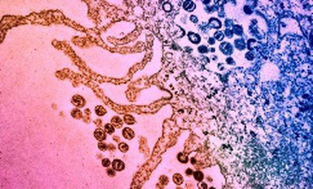 Phân tử kháng sinh cho phép hệ miễn dịch tiêu diệt tế bào nhiễm HIV
