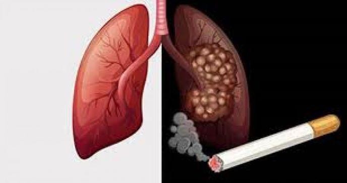 Hút thuốc - yếu tố nguy cơ của COVID-19