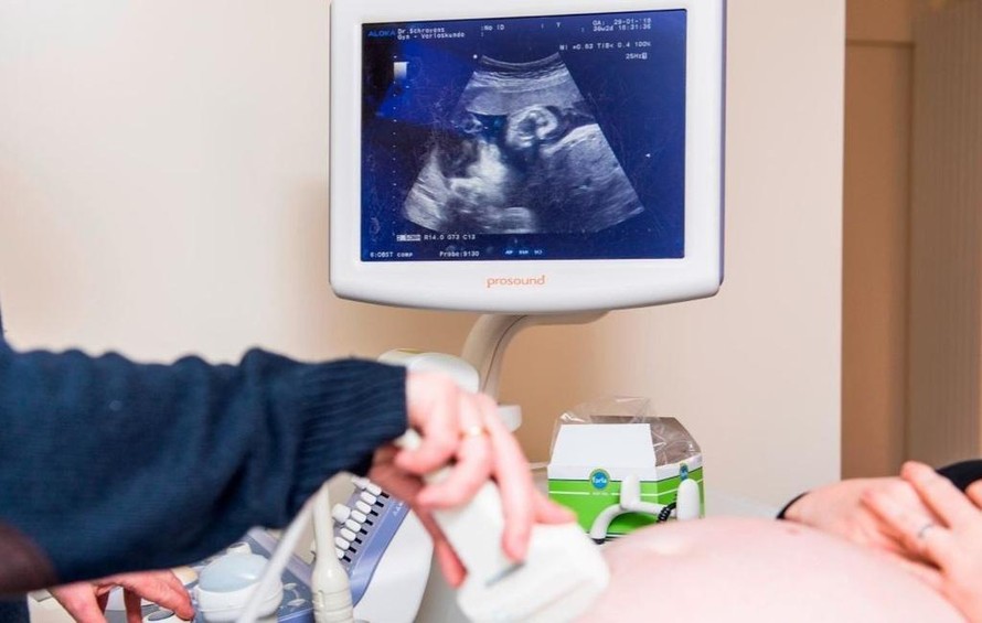Phụ nữ mang thai có thể truyền kháng thể chống Covid-19 cho con. Ảnh: CNN.