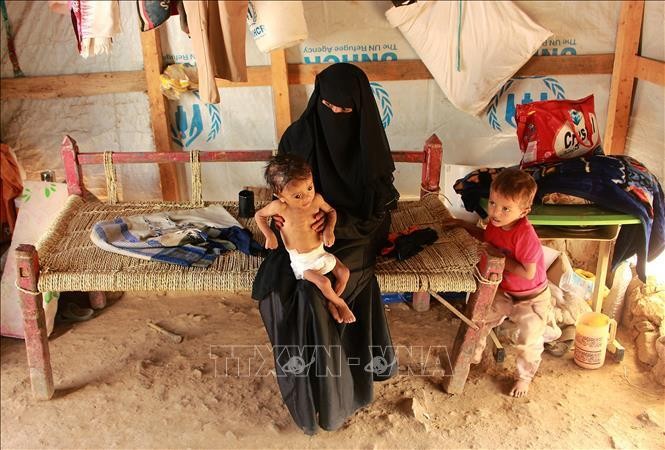 Trẻ em bị suy dinh dưỡng do nạn đói kéo dài ở Hajjah, Yemen. Ảnh: AFP/TTXVN