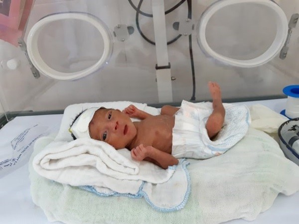 Em bé nặng 900 g được nuôi dưỡng thành công tại Bệnh viện Đa khoa huyện Bắc Hà. (Ảnh: Bệnh viện cung cấp)