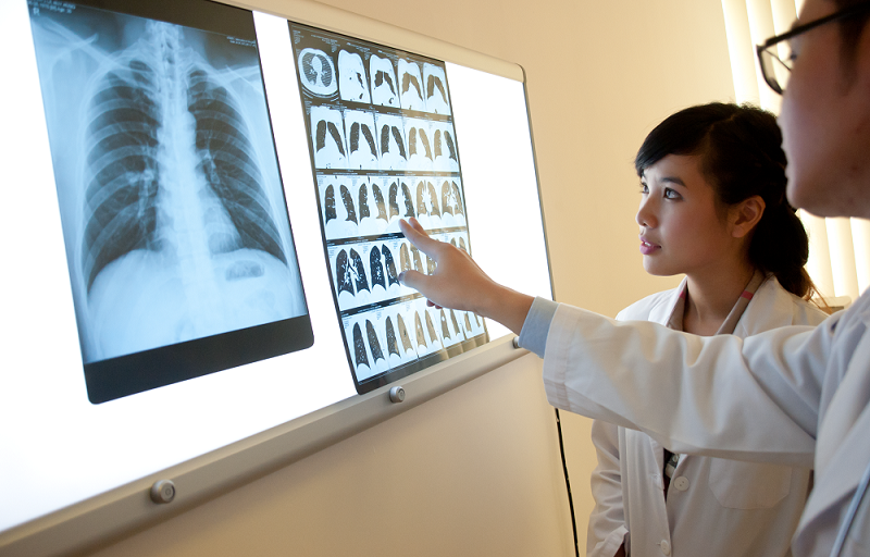 Ảnh X-quang được tiến hành phân loại, gán nhãn và xây dựng kho dữ liệu “vàng” hỗ trợ chẩn đoán, điều trị