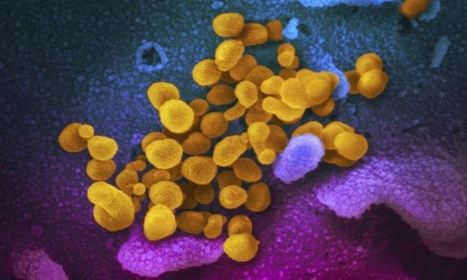 nCoV (màu vàng) bám trên bề mặt tế bào dưới kính hiển vi. - Ảnh: SCMP.