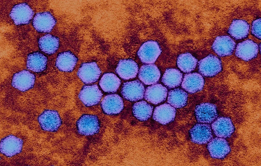WHO: Phát hiện virus bại liệt trong mẫu nước thải ở London (Anh)