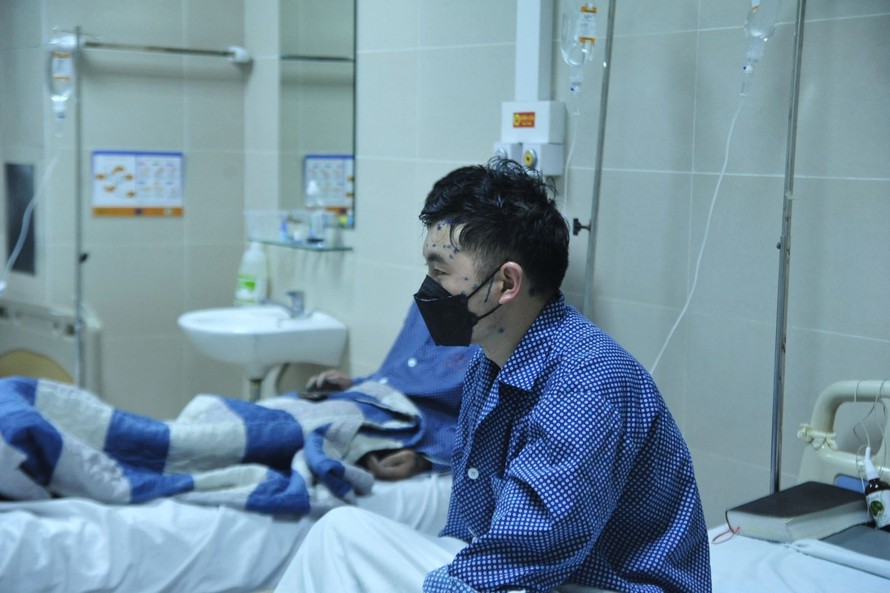 Bệnh nhân mắc thủy đậu gia tăng tại Hà Nội.